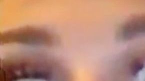 Imagen de las pestañas de la chica después del golpe / Tegan Denham.