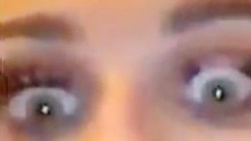 Imagen de las pestañas de la chica después del golpe / Tegan Denham.