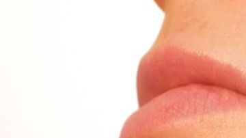 acne-Kjerstin Michaela Haraldsen en Pixabay