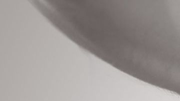 Riñones-insuficiencia-C