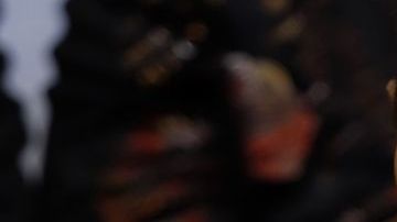 Ella dice que no se ha hecho nada en la cara, ¿le creen?