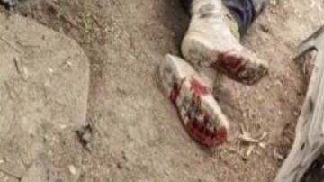 Fotos y Videos: Así quedaron 3 sicarios de la Tropa del Infierno tras atacar a policías