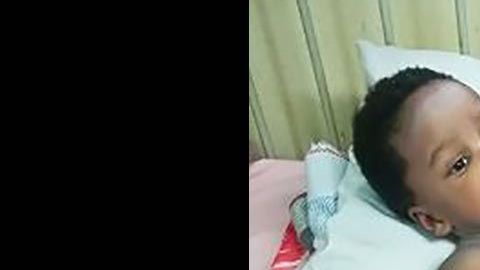 Las siamesas Mercy y Goodness.