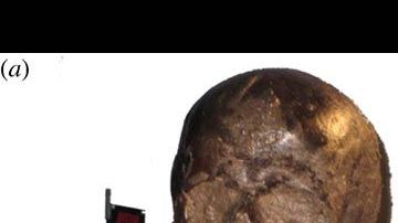 El cráneo y el pedazo de cerebro.