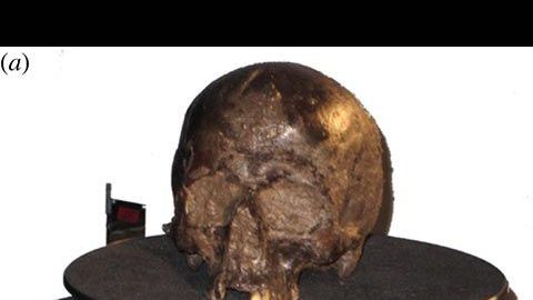 El cráneo y el pedazo de cerebro.