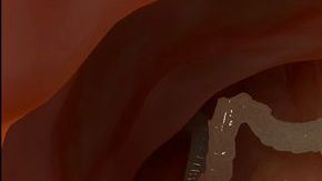 Los parásitos son peligrosos.