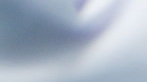 Una cuestión degenerativa podría ser la causa, además de algunos malos hábitos.