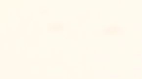 El uso ininterrumpido de lentes de contacto le provocó una úlcera que casi le hace perder la visión.