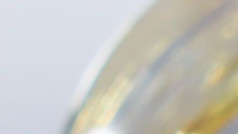 Dolor y ojos amarillos encendieron las alarmas.