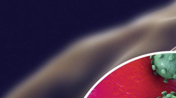 El coronavirus puede causar lesiones severas en los pulmones.