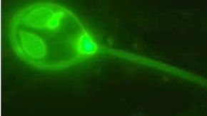 El parásito se aloja en el salmón y forma una especie de quistes.