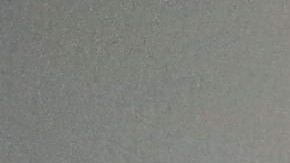 La vacuna para prevenir el coronavirus podría demorarse varios meses.