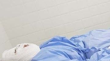 La mujer permanece en un hospital en Meknes, Marruecos.