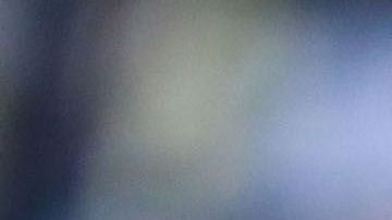 En unos días más, el chileno podrá iniciar su rehabilitación.