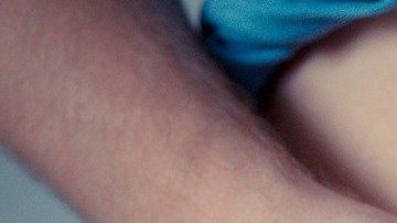 inflamado-sobrepeso-Michal Jarmoluk en Pixabay