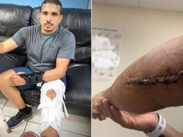 El oficial Ricardo Castillo sufrió graves heridas en su pierna y en su brazo izquierdos.