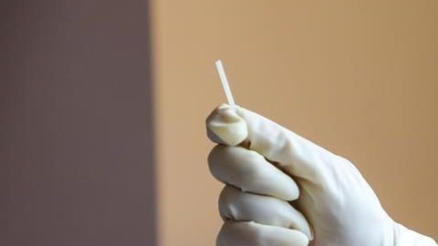 Recolecta de biomaterial de pacientes sospechosos de coronavirus.