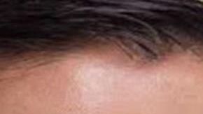 El esposo  trató de matarla a principio de año.