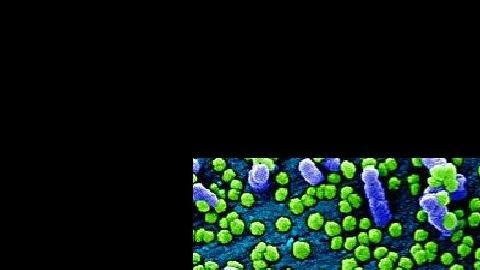 El momento en que el coronavirus ataca las células.