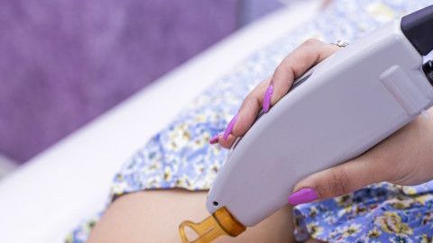 Depilación con láser en la piel de las piernas de una mujer.