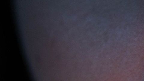 Se van descubriendo efectos secundarios del coronavirus.