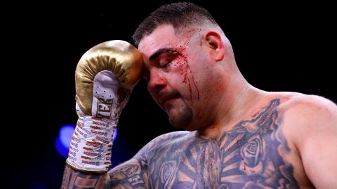 Andy Ruiz ha estado rodeado de escándalos, luego de caer frente a Anthony Joshua.