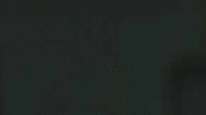 Imagen ilustrativa de un parto por cesárea.