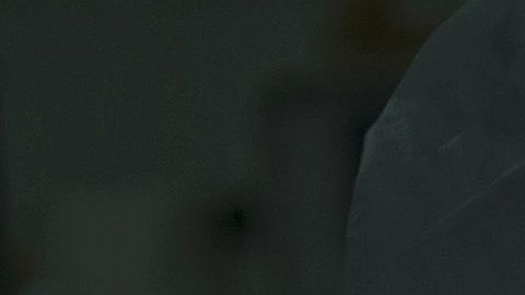 Imagen ilustrativa de un parto por cesárea.