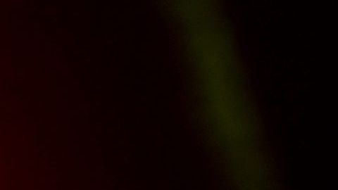 Zion estuvo hospitalizado en el hospital ABC de la Ciudad de México.