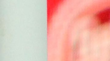 Chivas tiene tres bajas por este padecimiento.