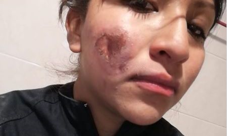 Lucero Velasco San Juan muestra el daño en su rostro.