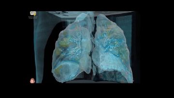 Así se aprecian los pulmones en el video.