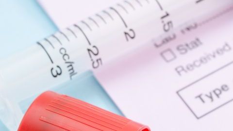 Ya no detectan VIH en el paciente de Londres.