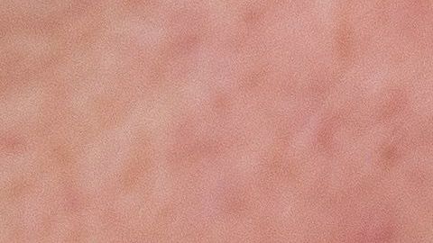 Otros países han examinado proporcionalmente a más personas.