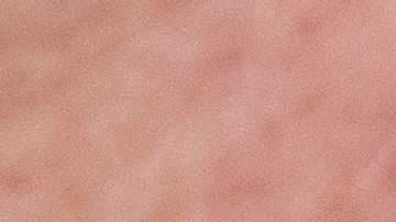 Otros países han examinado proporcionalmente a más personas.