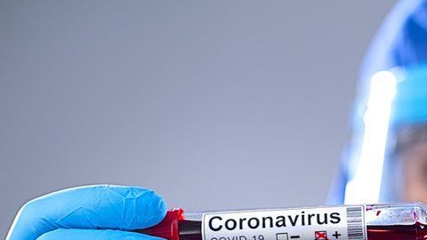 Hasta la fecha, no existe un tratamiento o vacuna contra el covid-19.