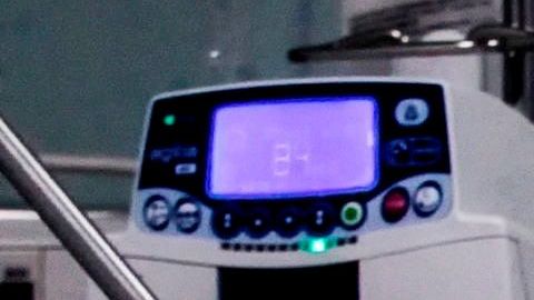 Algunos síntomas del COVID-19 han sorprendido a los médicos.