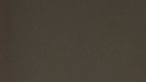 La enfermera descubrió que antes de morir, los pacientes con coronavirus presentan ojos rojos.