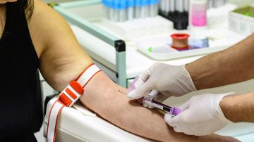 sangre laboratorio examen