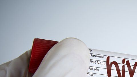 El VIH generó la mayor pandemia que vivió el mundo a finales del siglo XX.