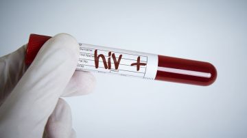 El VIH generó la mayor pandemia que vivió el mundo a finales del siglo XX.