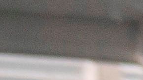 Si desarrollan algún problema cardíaco, el panorama de los enfermos empeora.