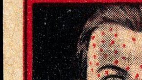 97087793_-left_face_of_a_man_suffering_from_smallpox_-right_vaccin_wellcome_l0027419