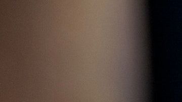 El pequeño sufrió una grave lesión en la cabeza que puso en riesgo su vida.