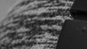 Sin los cuidados necesarios, los niños podrían terminar con pérdida de audición, dificultades de comunicación y síntomas angustiantes de zumbido de los oídos, plenitud auditiva, sensibilidad y dolor.