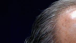 El sobrino del exmandatario estaba a bordo de un auto oficial.