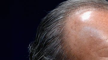 El sobrino del exmandatario estaba a bordo de un auto oficial.