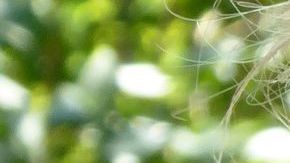 Un melanoma es un tipo de cáncer de piel que puede comenzar en un lunar. Detectado temprano, el melanoma es altamente tratable.