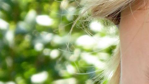 Un melanoma es un tipo de cáncer de piel que puede comenzar en un lunar. Detectado temprano, el melanoma es altamente tratable.