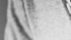 corazón-infarto.pexels